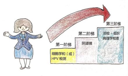 宮頸癌篩查三階梯