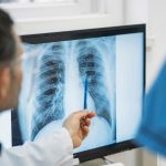 不同类型肺小结节：应区别对待