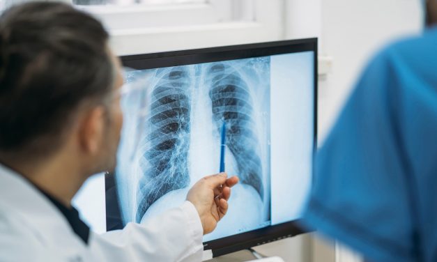 不同类型肺小结节：应区别对待