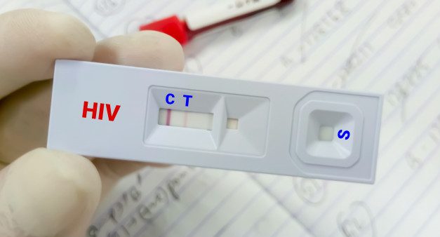 艾滋病自测试纸带来的烦恼