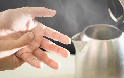 烧烫伤急救，你做对了吗？