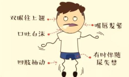 患了 “类风关”  且看中医巧调治
