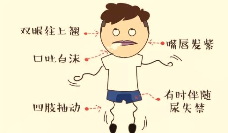患了 “类风关”  且看中医巧调治