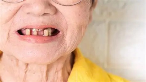 防治牙周病认识上需要纠错